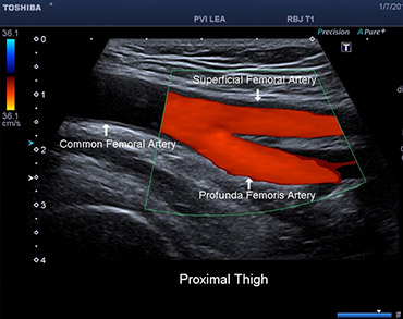 example-image